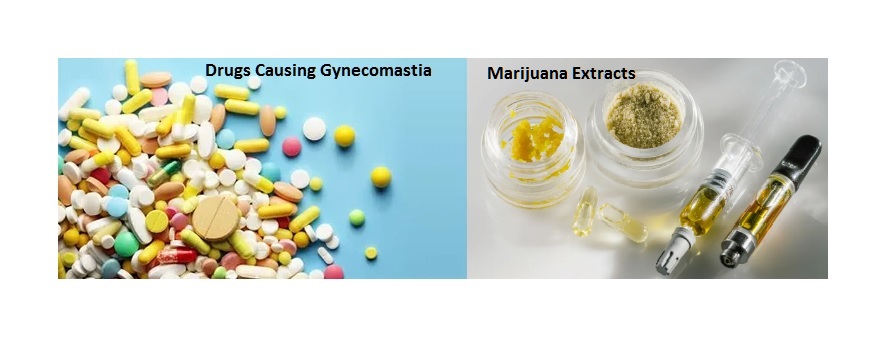 Drugs Causing Gynecomastia
