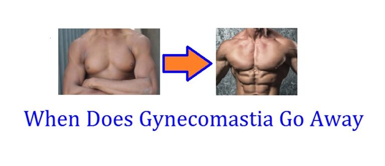 When Does Gynecomastia Go Away for Different Age Groups